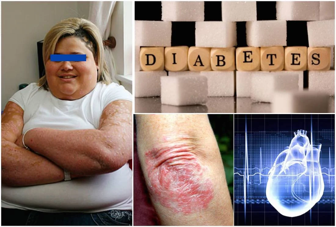 Psoriazin-daxili-orqanlarla-əlaqəsi.jpg